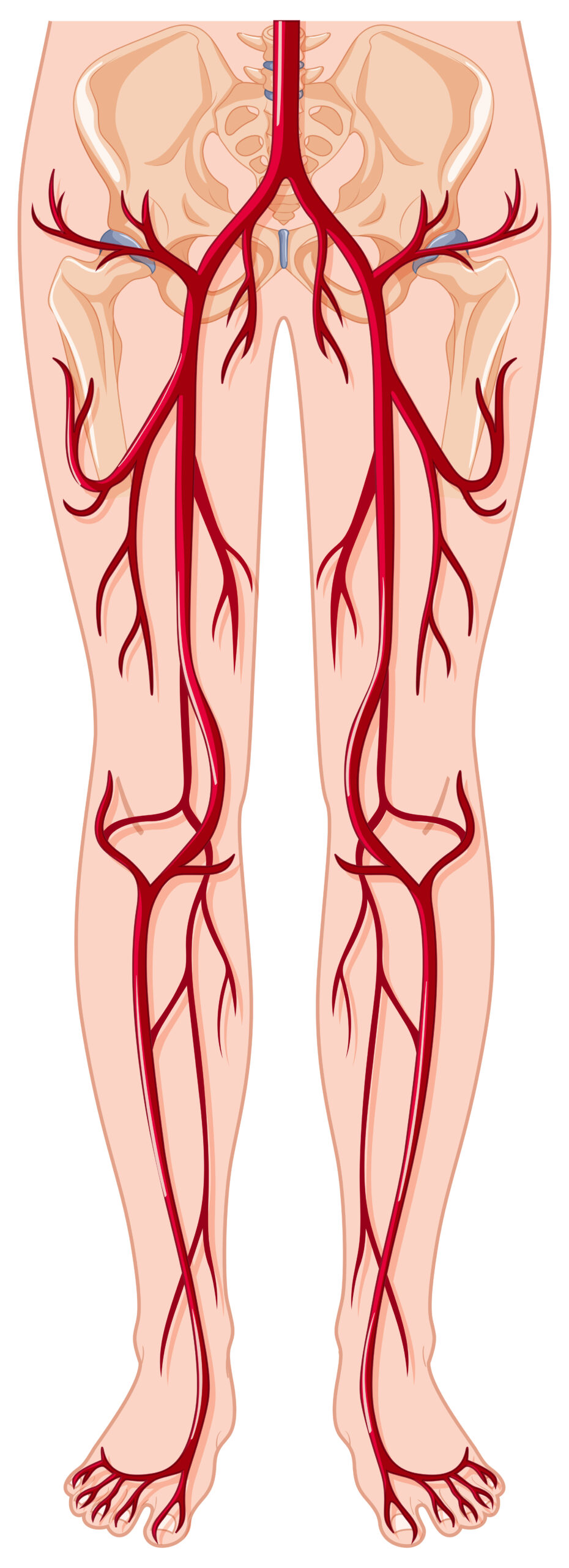 varice jambes cvp varices jambes symptomes